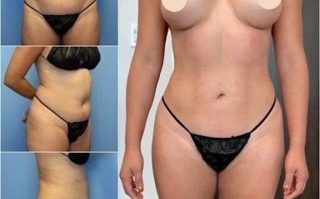Body Contouring in Dubai: A Guide to Achieving the Perfect Shape
