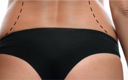 Body Contouring in Dubai: Customize Your Dream Silhouette with Modern Techniques