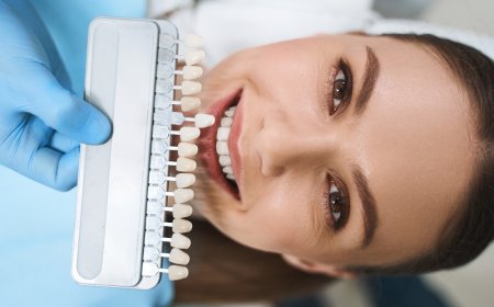 Top Benefits of Choosing Zirconia Crowns for Long-Lasting Dental Health