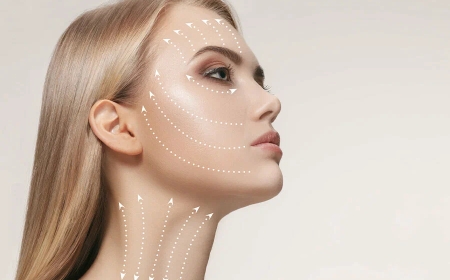 Acne Treatment in Beverly Hills: The Path to Clear, Radiant Skin