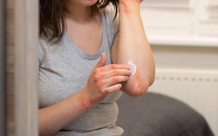 Ivercor 6mg: Clinical Evidence and Real-World Success