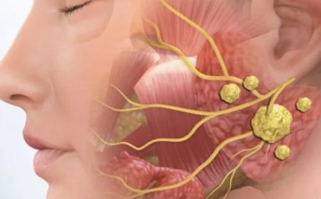 Understanding Salivary Gland Cancer and Getting the Right Treatment in Hyderabad