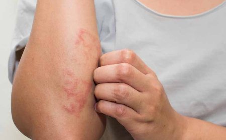 Expert Skin Solutions: Trusted Care for Eczema, Skin Cancer, and Scar Revision Near You