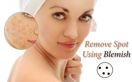 Best Acne Treatment, Eczema Specialists & Acne Scar Removal Near Me in Itasca