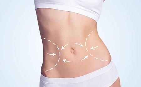 How Abdominoplasty in Dubai Helps Individuals Achieve Their Dream Body After Weight Loss