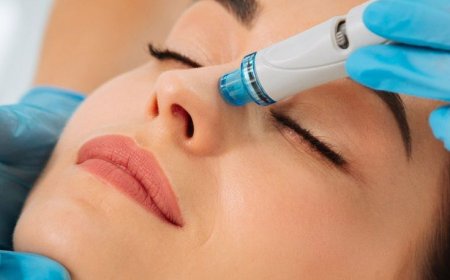 Microneedling Treatment for Face in Chelsea, London — Benefits for Face, Hair, Acne Scars & Stretch Marks