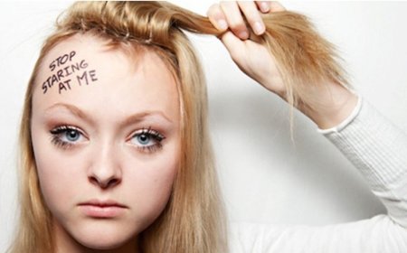 Guide to Treating Hair Pulling Disorder: Comprehending and Getting Rid of Trichotillomania