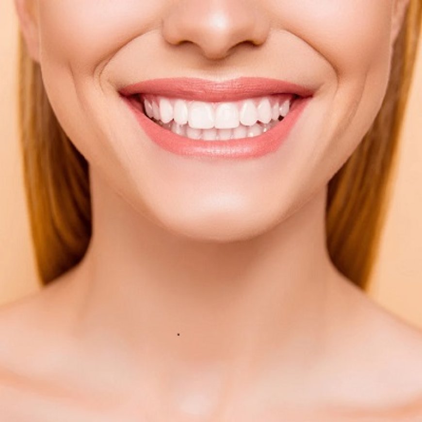 Discover the Secret to a Brilliant Smile with Teeth Whitening Riyadh