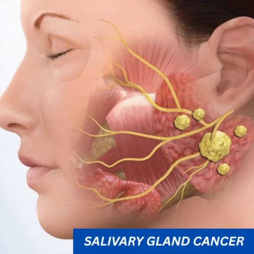 Understanding Salivary Gland Cancer and Getting the Right Treatment in Hyderabad